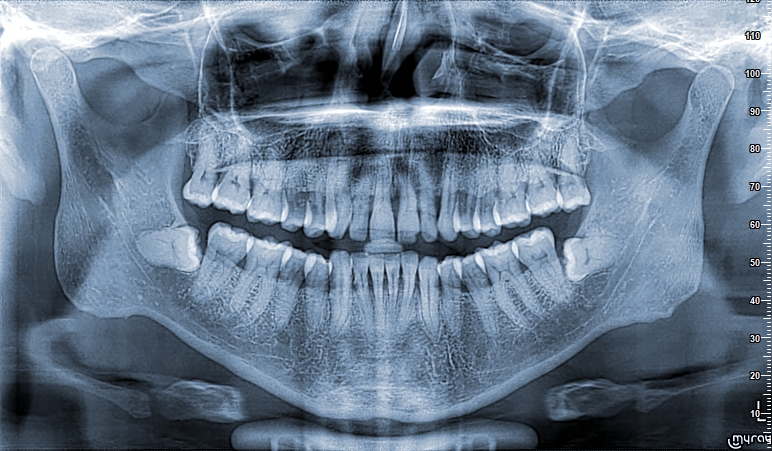 Contreras Varela_Humberto Leobardo_1983_01_18_PAN2309