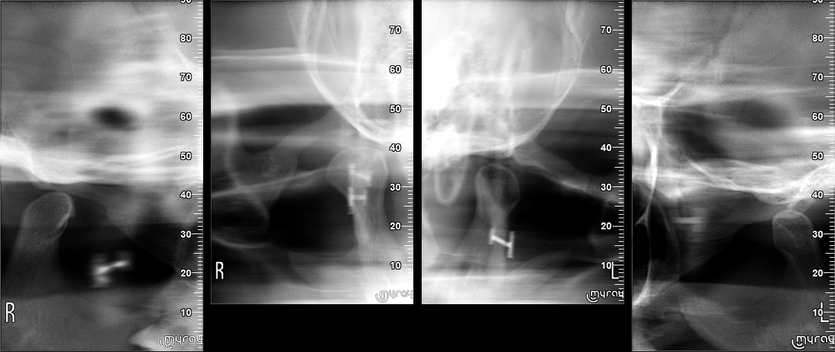 Mancilla Mateos_Andrea_2001_04_06_TMJ61_3