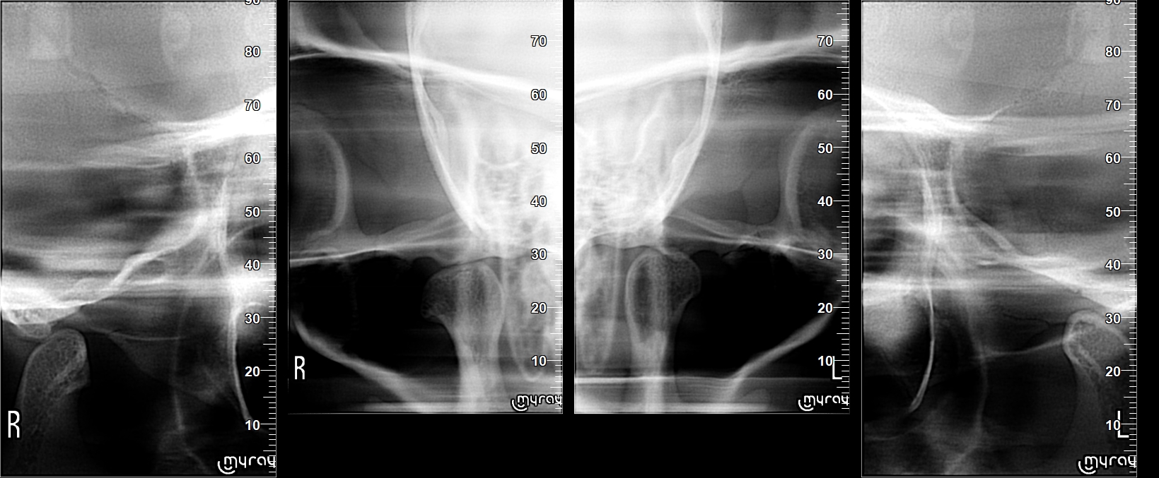 Salazar Cano_Pamela_1992_06_12_TMJ73_1