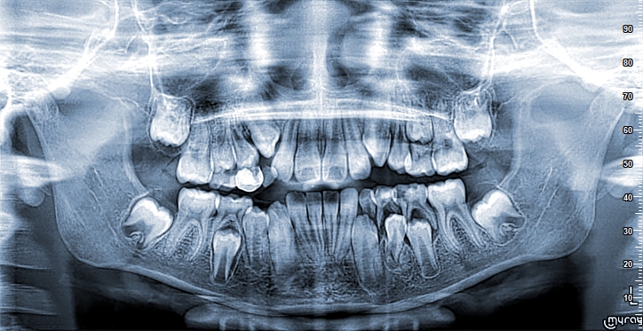 Seseña Carrillo_Pedro Alexander_2009_08_03_PAN08