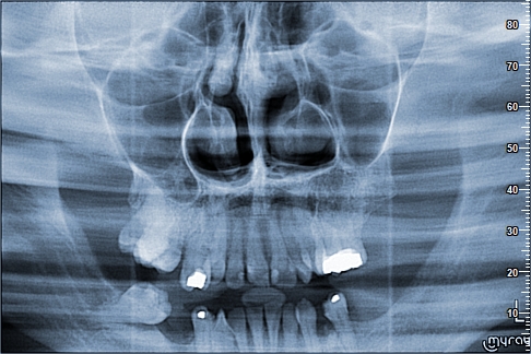 Torales Viveros_Rocio_1973_06_09_SIN1206
